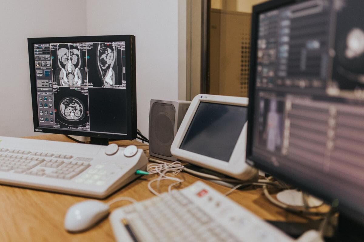 Onde procurar e como filtrar anúncios Monitores exibindo exames de imagem em uma estação de trabalho de laudos